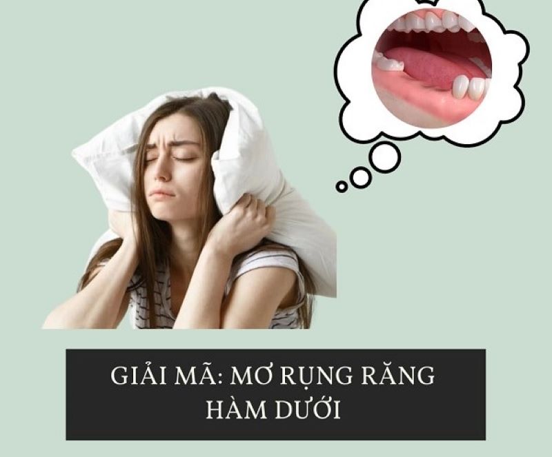 nằm mơ thấy rụng răng hàm dưới