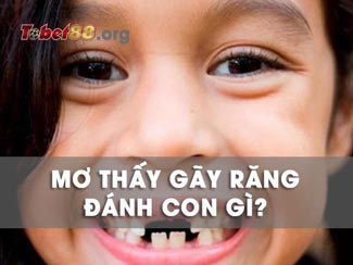 Nằm mơ thấy gãy răng có ý nghĩa gì theo khoa học & tâm linh?